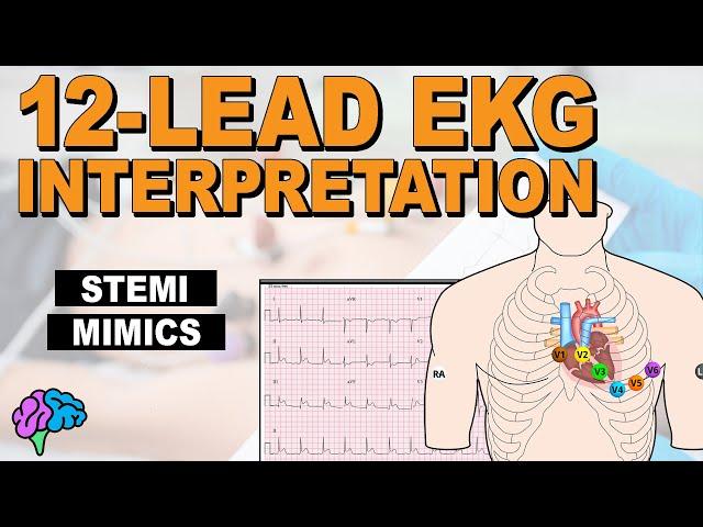 HOW-TO Recognize STEMI Mimics on 12-Lead EKG!