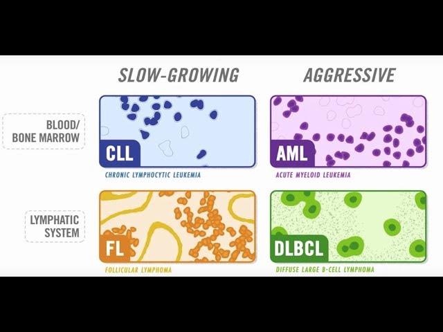 The Diversity Of Blood Cancer