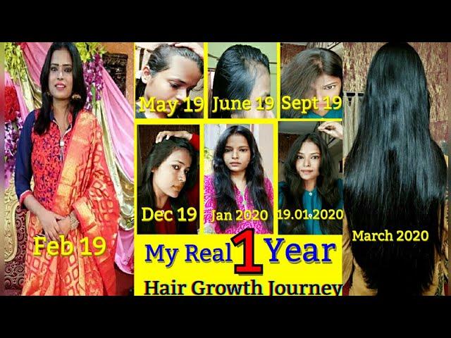 My Real 1 Year Hair Growth Journey With Pictures Before After | How I Grow My Hair | Shinny Roops