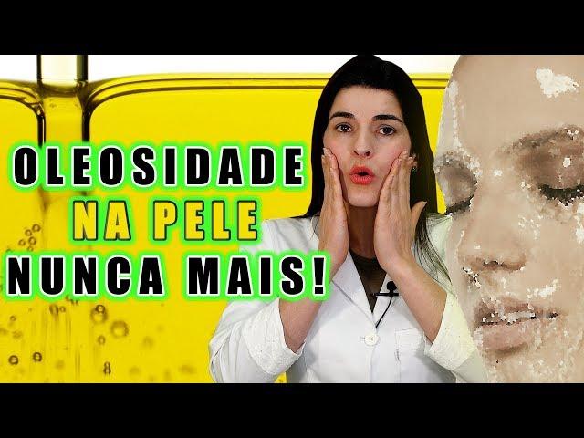 FIM da PELE OLEOSA | Acabe com a Oleosidade Excessiva