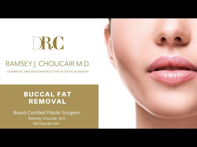 Buccal Fat Removal | Ramsey Choucair, M.D. | Dallas, TX | Ph: 214-389-9797