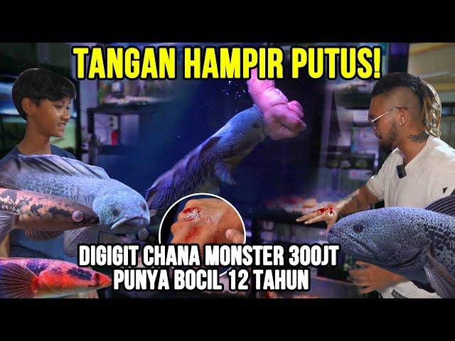 GELO!! TANGAN HAMPIR PUTUS! DIGIGIT CHANA MONSTER 300JT PUNYA BOCIL 12 TAHUN! #KINGOFTHEJUNGLE