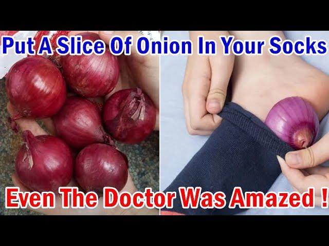 Put An Onion In Your Socks Before Bed, This Amazing Thing Will Happen To Your Health! Natural Remedy