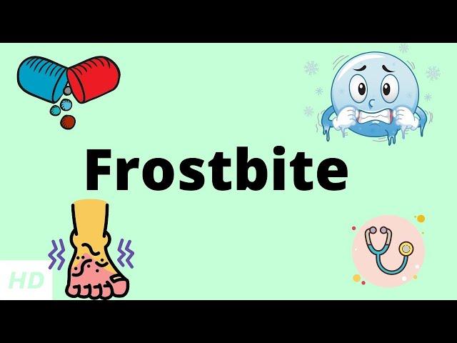 Frostbite, Causes, Signs and Symptoms, DIagnosis and Treatment.