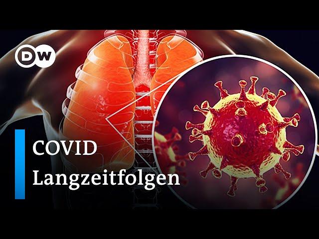 Long Covid: Wenn Coronavirus Symptome nicht verschwinden | DW Nachrichten