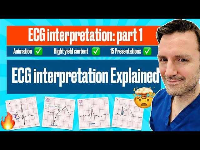 #ecg interpretation : The animated Visual Guide with ECG Criteria #electrocardiogram