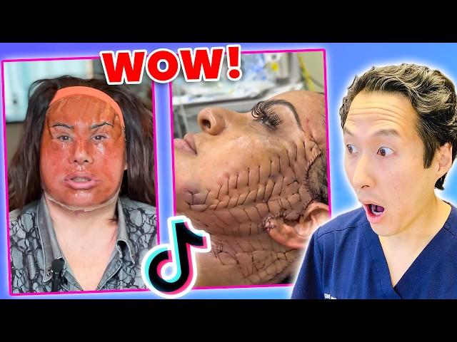 Plastic Surgeon Reacts to INSANE Plastic Surgery TikToks!