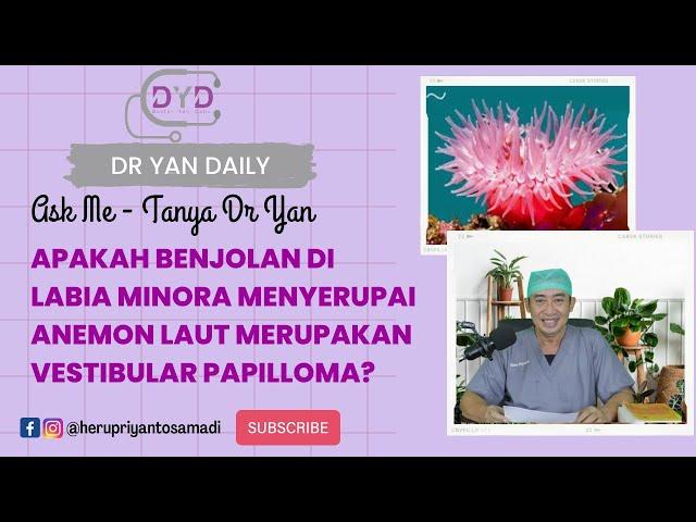 Ask Me | KUTIL KELAMIN | Apakah Benjolan di Labia Minora Mirip Anemon Laut Itu Vestibular Papilloma?