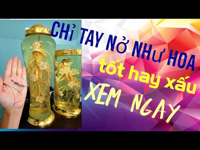 Bí ẩn Chỉ  tay nở hoa có  liên quan gì  đến  bệnh tim và  triệu  chứng đột quỵ,xem ngay kẻo tiếc