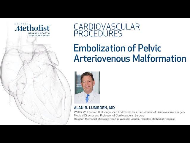 Embolization of Pelvic Arteriovenous Malformation (Alan B. Lumsden, MD)