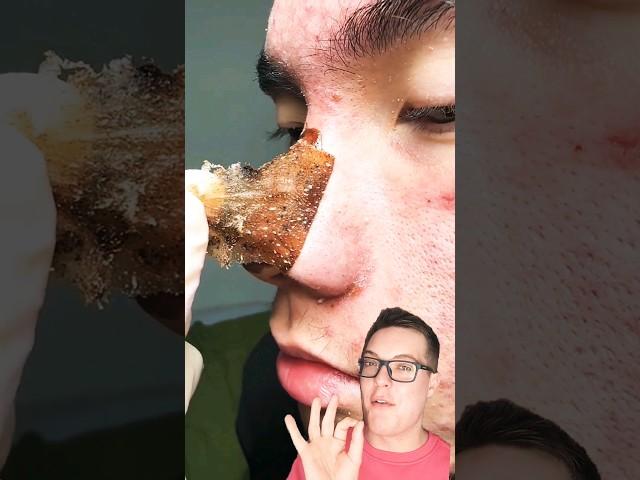 WOW - Crazy Satisfying PORE STRIP REMOVAL #shorts