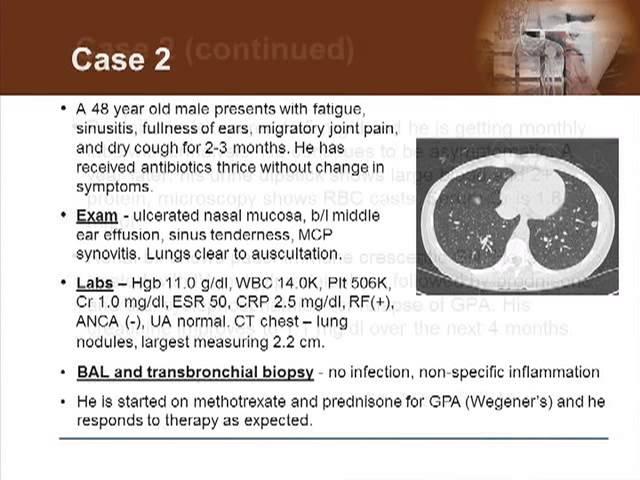 Detecting Vasculitis Before It's Too Late