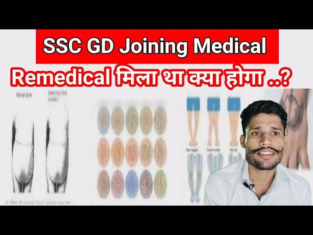 SSC GD Joining Medical ।। Remedical मिला था क्या होगा ..?