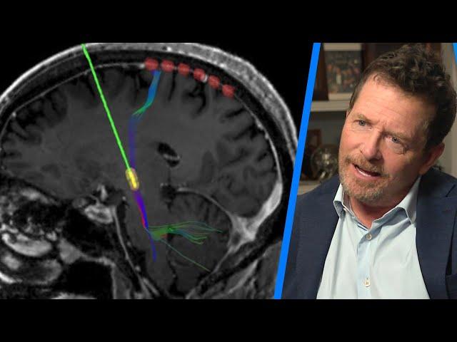 Beating Parkinson's Disease: Overview, Research, and Latest Treatment Developments