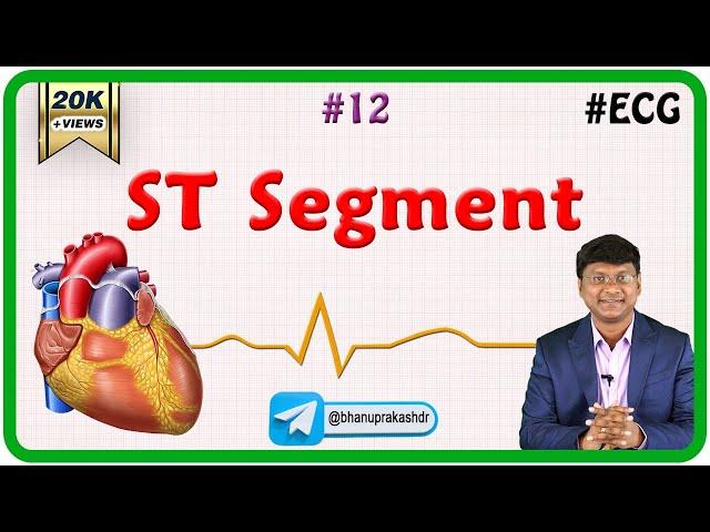 12. ST Segment - ECG assessment and ECG interpretation made easy