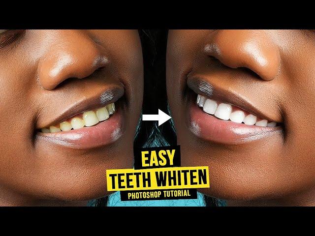 How to WHITEN TEETH in Photoshop | Easy Retouching Tutorial