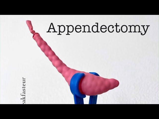 Playdough Surgery 🪱 - Open Appendectomy