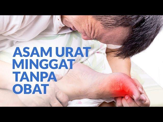 Cara Alami Menurunkan Asam Urat Yang Dianjurkan Dokter