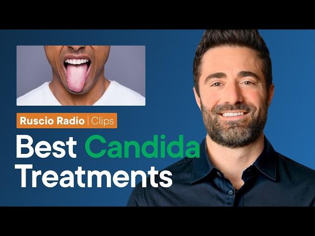 The Top 3 BEST Treatments For Your Candida (And How to Use Them)