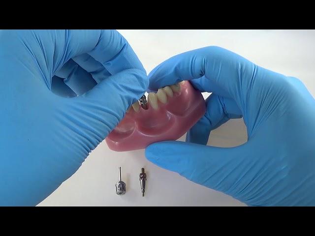 Straumann® Open Tray Impression Coping Technique