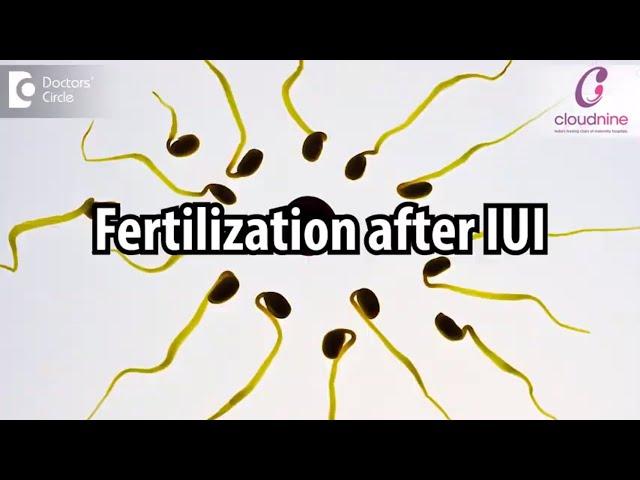 How long does it take for Fertilization after IUI ? - Dr. Veena Shinde of Cloudnine Hospitals