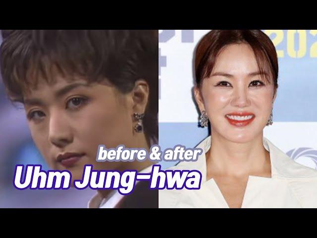 Uhm Jung-hwa before and after