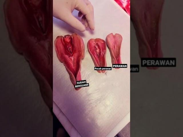 PERBEDAAN PECAHNYA PERAWAN PADA PEREMPUAN#shorts ,#trending DI SUBSCRIBE 