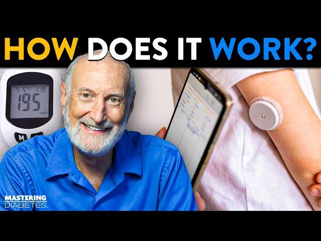 How Does a Continuous Glucose Monitor (CGM) Work? | Mastering Diabetes