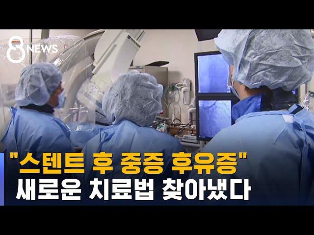 "스텐트 후 중증 후유증"…새로운 치료법 찾아냈다 / SBS