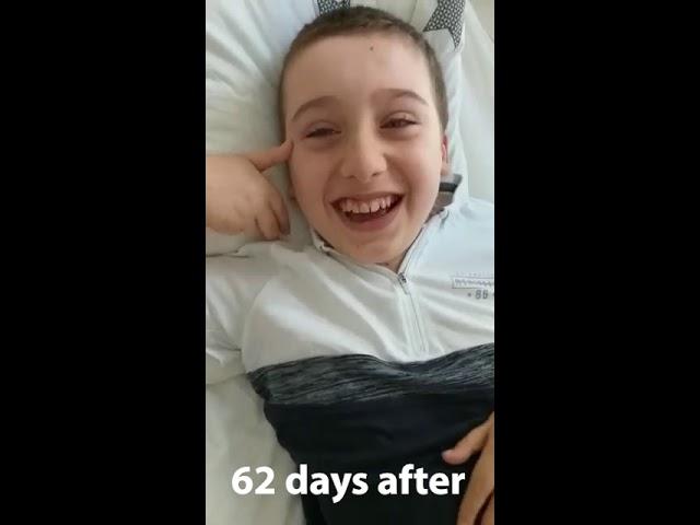 Kacper's AADC Gene Therapy Journey