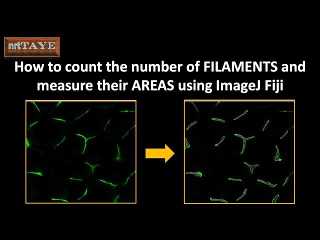 How to count the number of FILAMENTS and measure their AREAS using ImageJ Fiji
