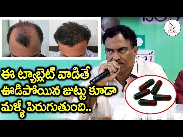 VRK Suggestion for Hair Loss After Diet | Best Hair Fall Treatment | Eagle Media Works