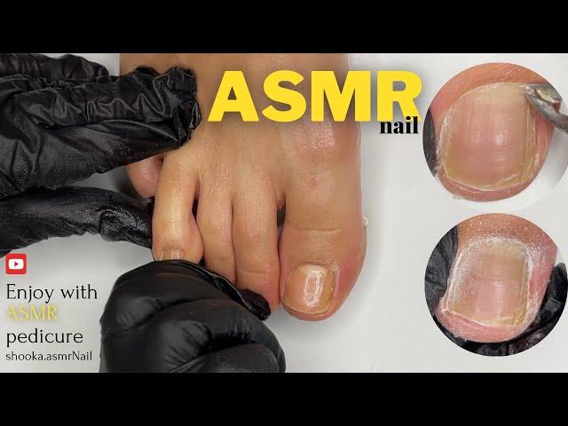 ASMR pedicure | asmr nail | cleaning pedicure asmr