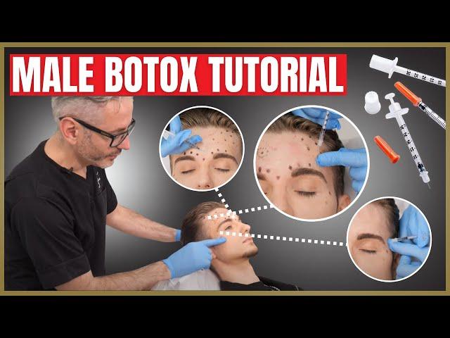 Botox Tutorial For Men | Botox Injection Patterns | Forehead, Corrugators & Crows Feet