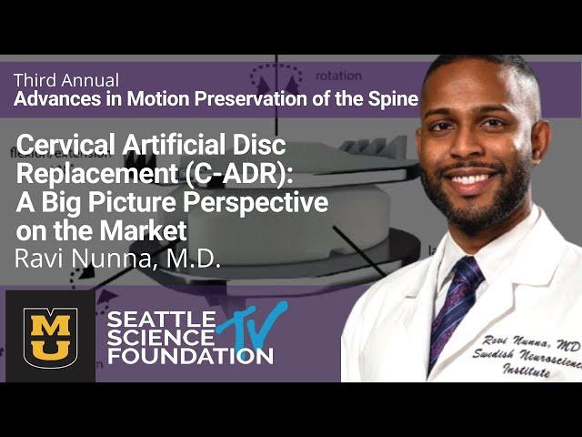 Cervical Artificial Disc Replacement (C-ADR)- Ravi Nunna, M.D.