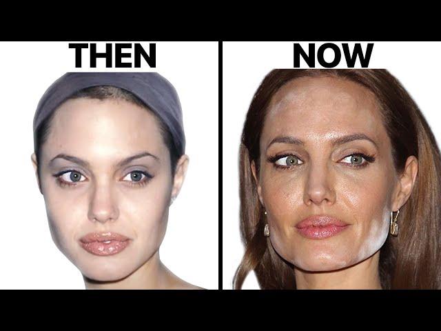 Angelina Jolie NEW FACE | Plastic Surgery Analysis