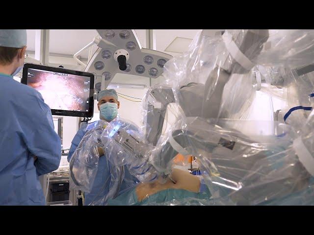 Робот-ассистированная рукавная резекция желудка (бариатрическая операция)