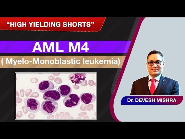 High Yielding Shorts-31 (#HYS-31) : AML M4 ( Myelo-Monoblastic leukemia) by Devesh Mishra.