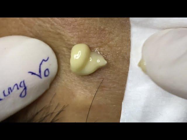 Satisfying video with Chung Vo Spa #137