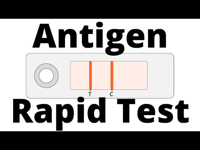 How SARS-CoV2 Antigen Rapid Tests work (Covid-19 Testing)