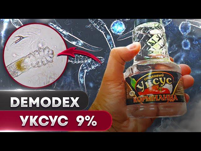 Уксус 9% против клеща | Угревая Железница Demodex