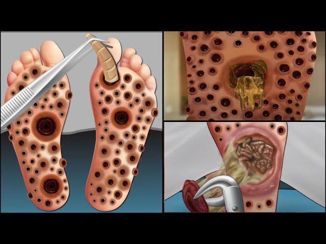 ASMR Treatment Animation | Severely Injured Animation | Foot Care Animation | Universe 팅거 ASMR