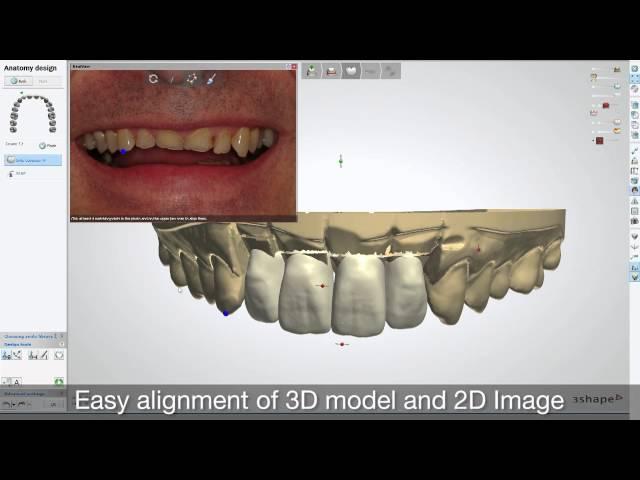 RealView Engine im WIELAND 3shape DentalSystem 2013