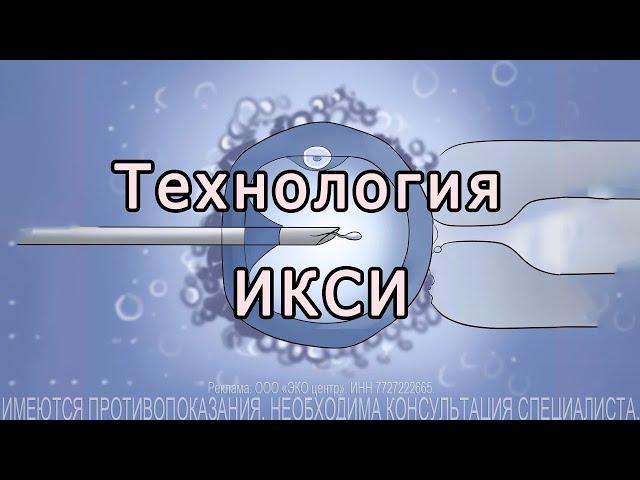 Технология ИКСИ