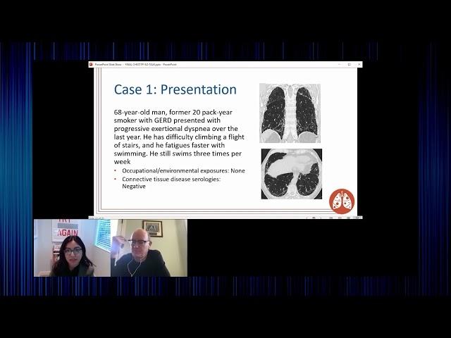 PF-ILD: Diagnosis and Treatment Considerations