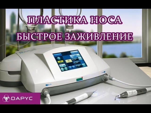 Пластика носа Алматы. Быстрое восстановление