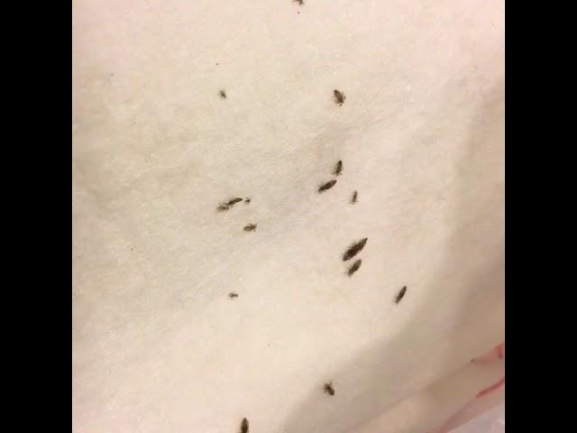 3 Month Lice Infestation