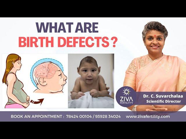 Most Common Birth Defects || Congenital Anomalies || Dr C Suvarchalaa || ZIVA Fertilityy