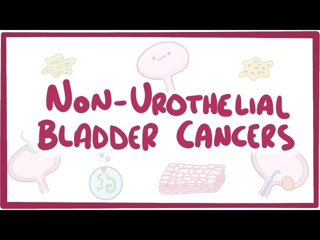 Non-urothelial cell bladder cancers - causes, symptoms, diagnosis, treatment, pathology