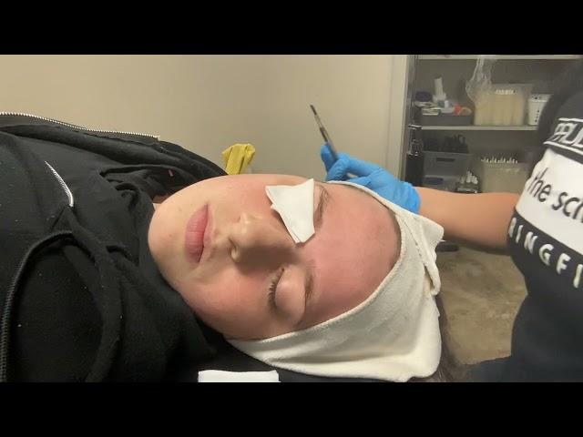 Dermaplane #1 (Nikki Duaban)